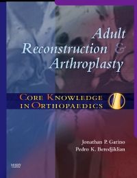 Core Knowledge in Orthopaedics: Adult Reconstruction and Arthroplasty