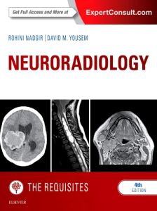 Neuroradiology: The Requisites