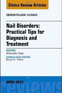 Nail Disorders: Practical Tips for Diagnosis and Treatment, An Issue of Dermatologic Clinics