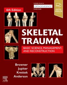 Skeletal Trauma