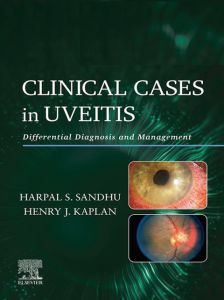 Clinical Cases in Uveitis