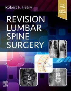 Revision Lumbar Spine Surgery