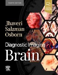 Diagnostic Imaging: Brain