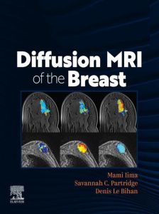 DIFFUSION MRI OF THE BREAST