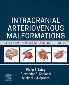 Intracranial Arteriovenous Malformations