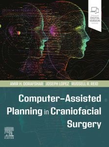 Computer-Assisted Planning in Craniofacial Surgery