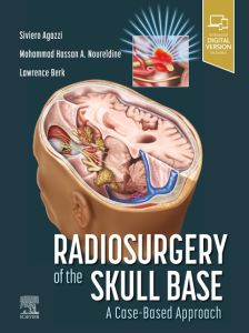 Radiosurgery of the Skull Base: A Case-Based Approach