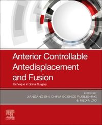 Anterior Controllable Antedisplacement and Fusion