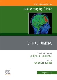 Spinal Tumors, An Issue of Neuroimaging Clinics of North America