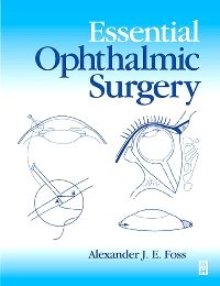 Essential Ophthalmic Surgery