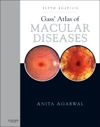 Gass' Atlas of Macular Diseases