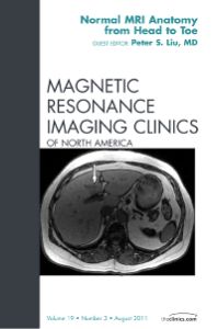 Normal MR Anatomy, An Issue of Magnetic Resonance Imaging Clinics