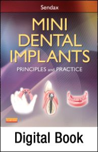 Mini Dental Implants