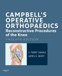 Campbell's Operative Orthopaedics: Reconstructiv
