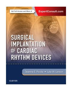 Surgical Implantation of Cardiac Rhythm Devices