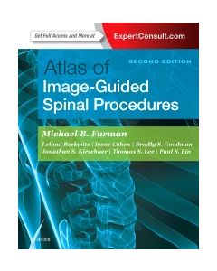 Atlas of Image-Guided Spinal Procedures