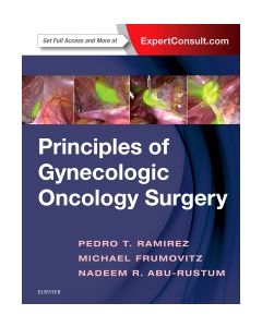 Principles of Gynecologic Oncology Surgery