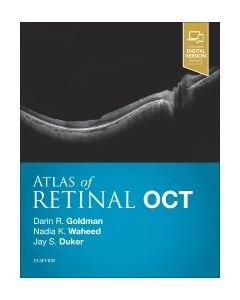 Atlas of Retinal OCT: Optical Coherence Tomography