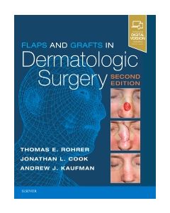 Flaps and Grafts in Dermatologic Surgery