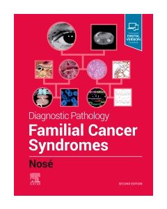 Diagnostic Pathology: Familial Cancer Syndromes