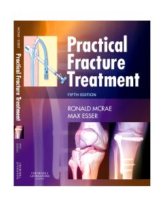 Practical Fracture Treatment