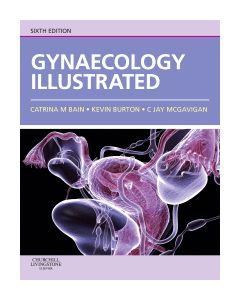 Gynaecology Illustrated