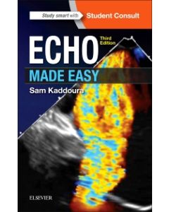 Echo Made Easy