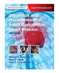 Diagnosis and Management of Adult Congenital Heart Disease