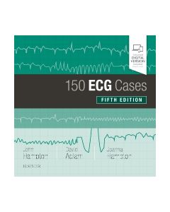 150 ECG Cases