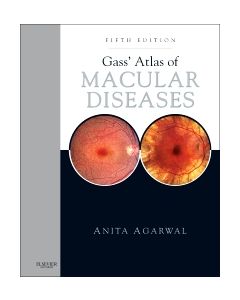 Gass' Atlas of Macular Diseases