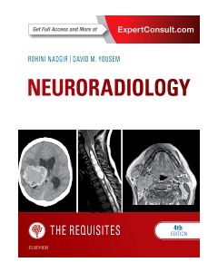 Neuroradiology: The Requisites